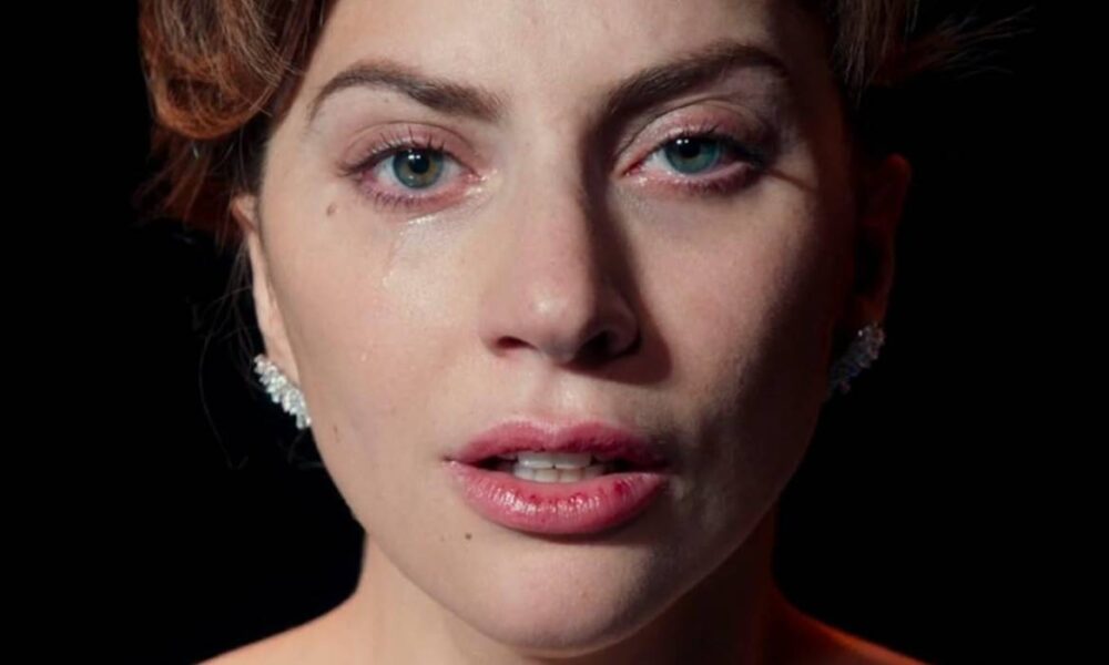 lady gaga topo