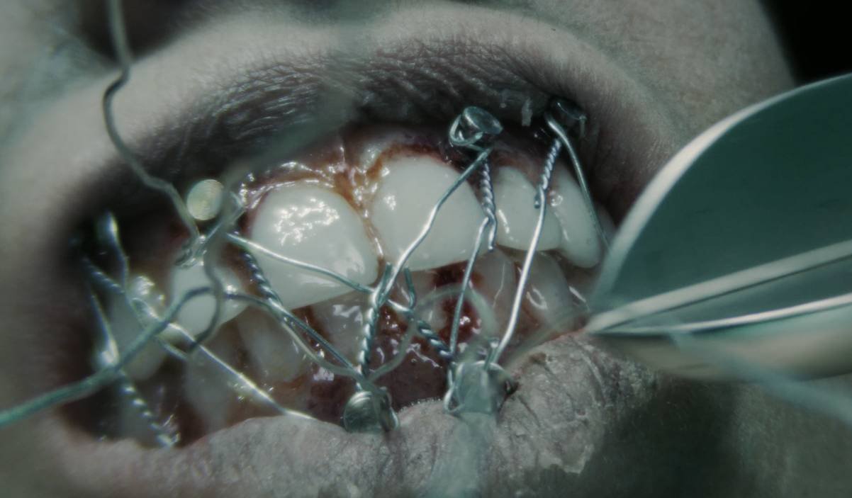 The Mortuary Assistant topo